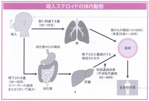 吸入ステロイド薬