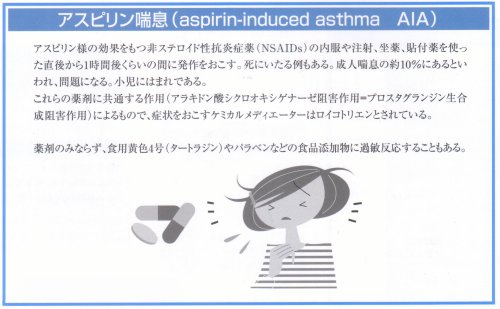 アスピリンぜんそく
